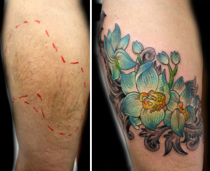 AD-Mastectomy-Abuse-Scar-Women-Free-Tattoo-Flavia-Carvalho-Daedra-Art-Brasil-01