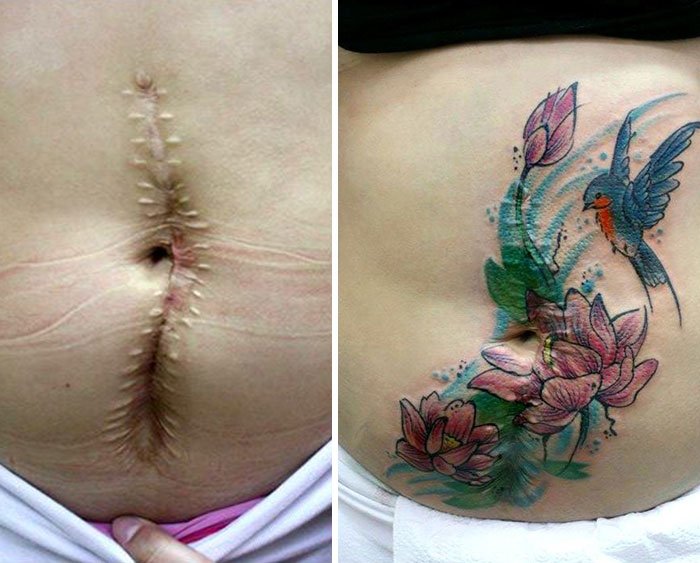 AD-Mastectomy-Abuse-Scar-Women-Free-Tattoo-Flavia-Carvalho-Daedra-Art-Brasil-02