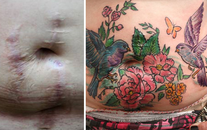 AD-Mastectomy-Abuse-Scar-Women-Free-Tattoo-Flavia-Carvalho-Daedra-Art-Brasil-05