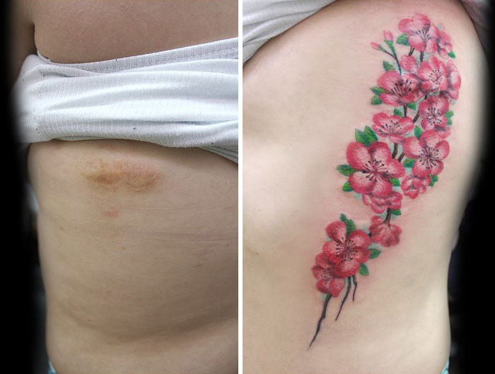 AD-Mastectomy-Abuse-Scar-Women-Free-Tattoo-Flavia-Carvalho-Daedra-Art-Brasil-07