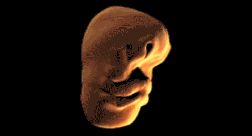 This gif shows the development of the human face in the womb