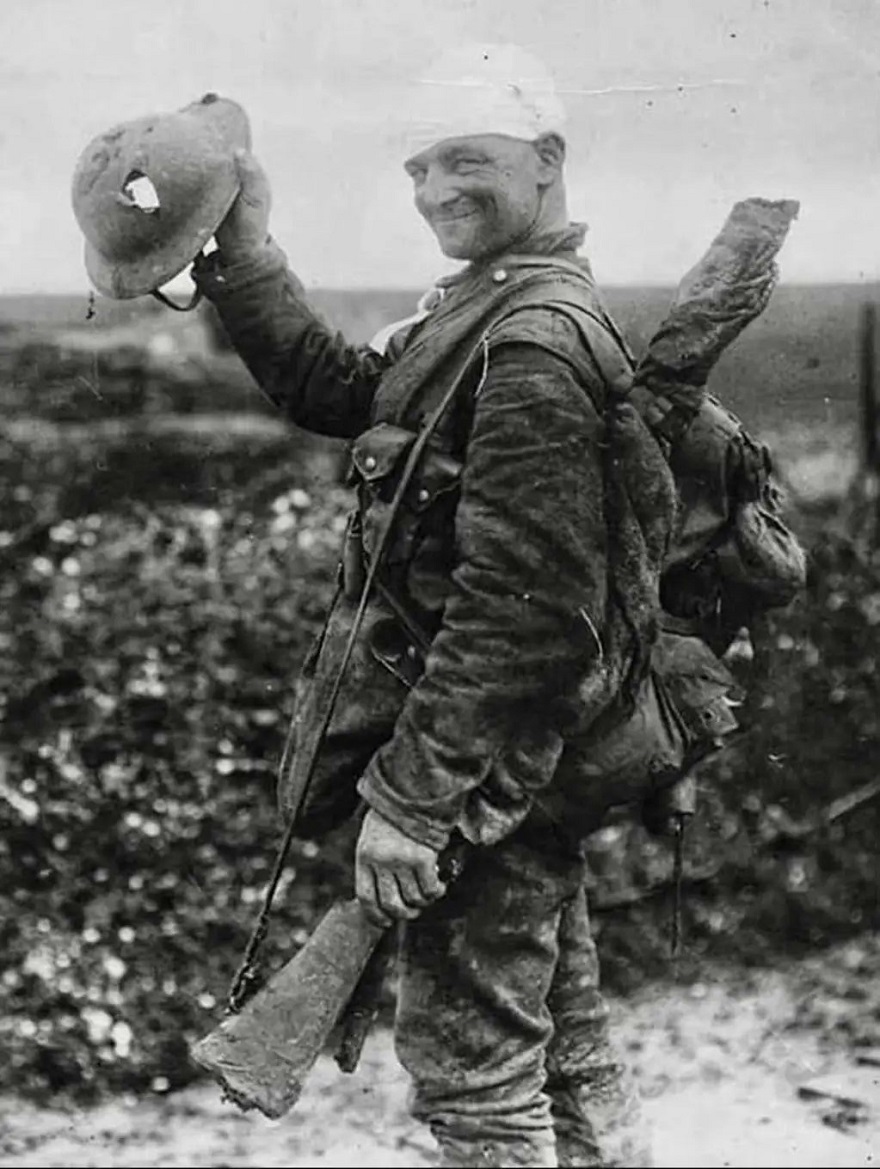 A Lucky British Soldier Smiles As He Shows Off His Damaged Helmet, 1917