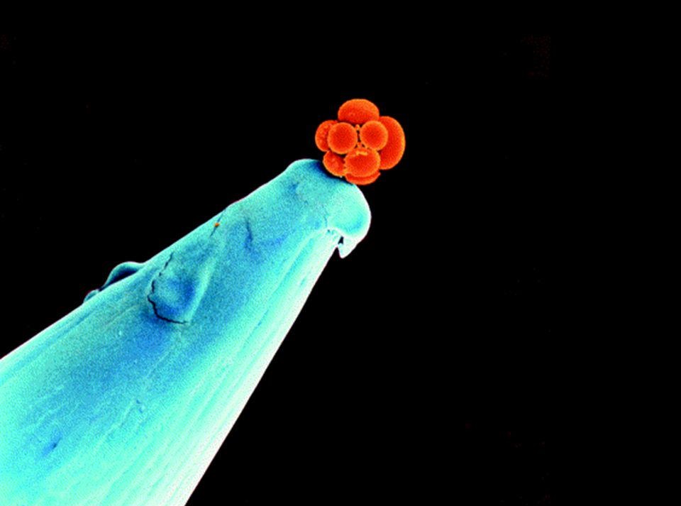 An Early Human Embryo On The Tip Of A Needle